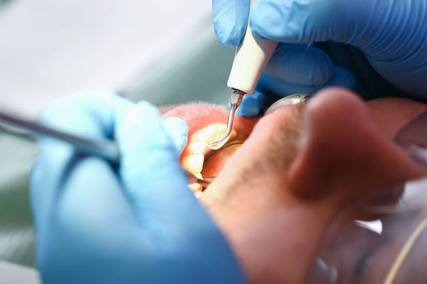 Best Emergency TMJ Treatment in Barview, OR
