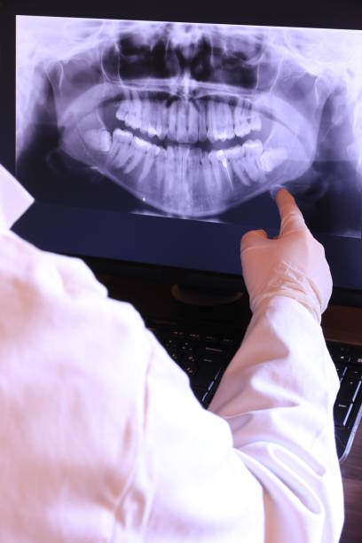Best Emergency Wisdom Teeth Removal in Barview, OR