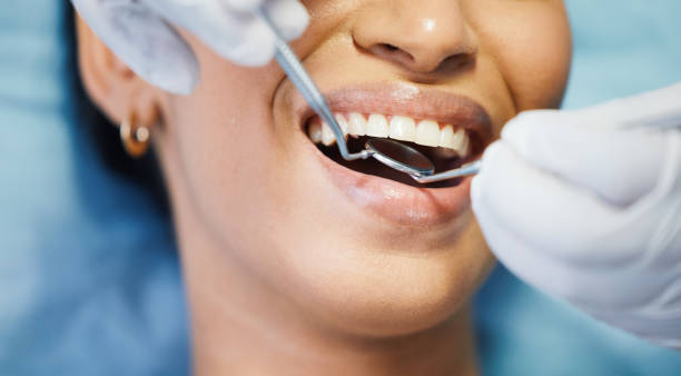 Best Emergency Dental Care for Broken or Chipped Teeth in Barview, OR